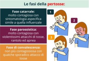 Bordetella pertussis Le tre fasi che caratterizzano la pertosse