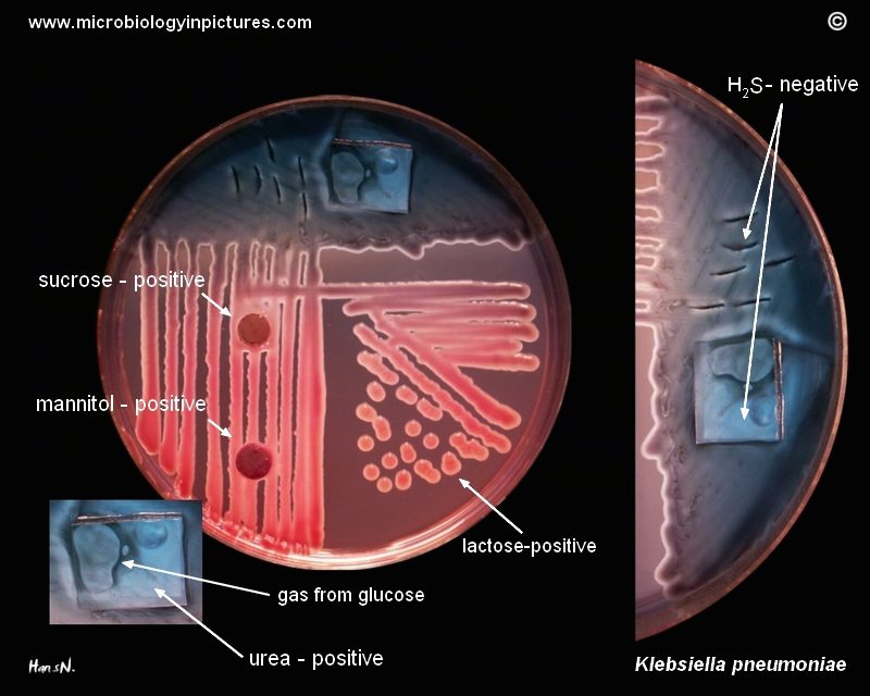 Dettaglio sull'identificazione di K. pneumoniae su piastra