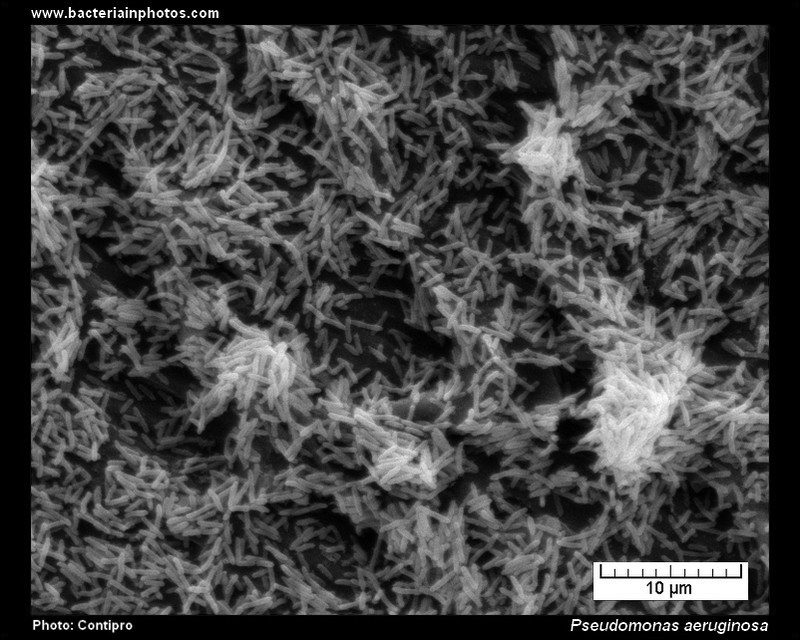 Figura 10 - Micrografia elettronica a scansione (SEM) di P. aeruginosa