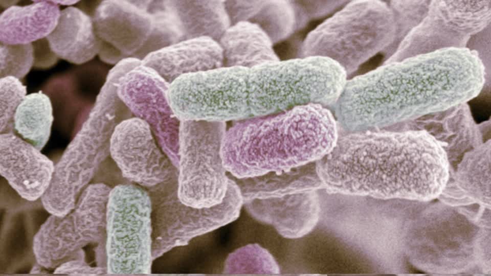 Immagine di E. coli ottenuta tramite microscopio elettronica a scansione (SEM)