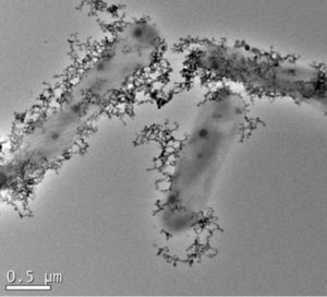 Acidithiobacillus ferrooxidans