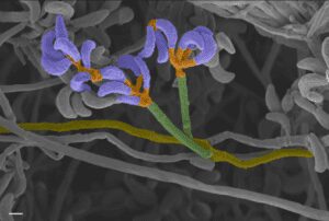 Pseudogymnoascus destructans (SEM falsi colori)