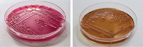 Figura 3 - Colonie di E. coli su MacConkey agar, rosa e giallo-ambra. 