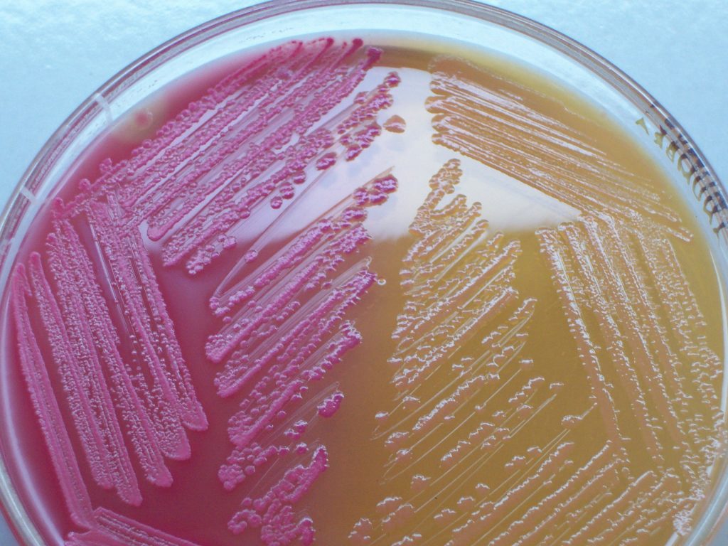 Figura 2 - Colonie lattosio fermentanti (a sinistra) e lattosio non fermentati (a destra) di E.coli agar su MacConkey 