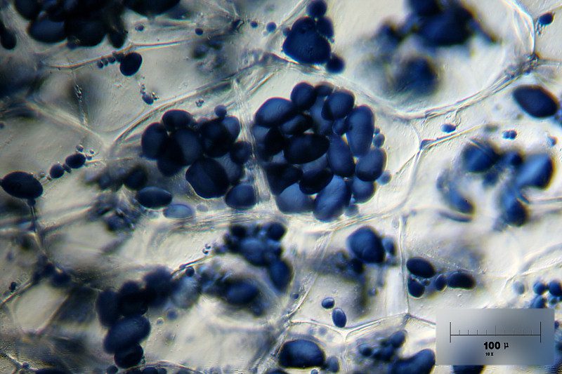 Granuli di amido evidenziati in blu, in cellule di patata.