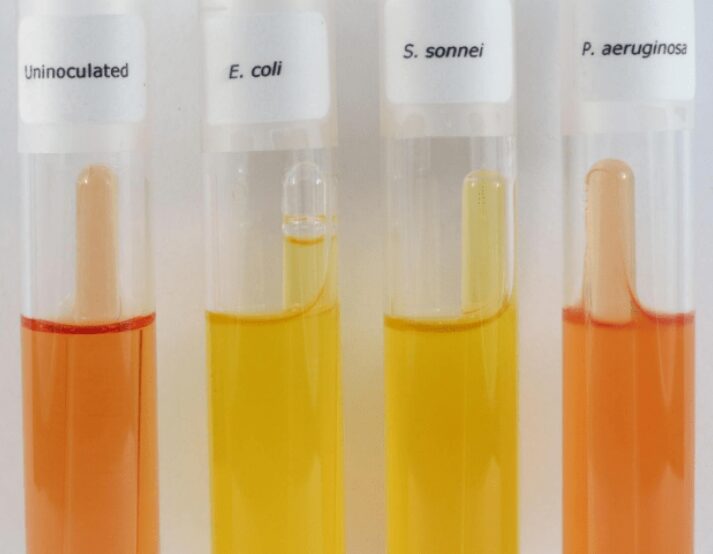 Figura 2 - Da sinistra a destra: 1) tubo non inoculato, 2) fermentazione del glucosio da parte di E. coli con produzione di gas (visibile bolla d'aria nella campanella di Durham), 3) fermentazione del glucosio da parte di S. sonnei senza produzione di gas (non visibile bolla d'aria nella campanella di Durham), 4) assenza di fermentazione da parte di P. aeruginosa