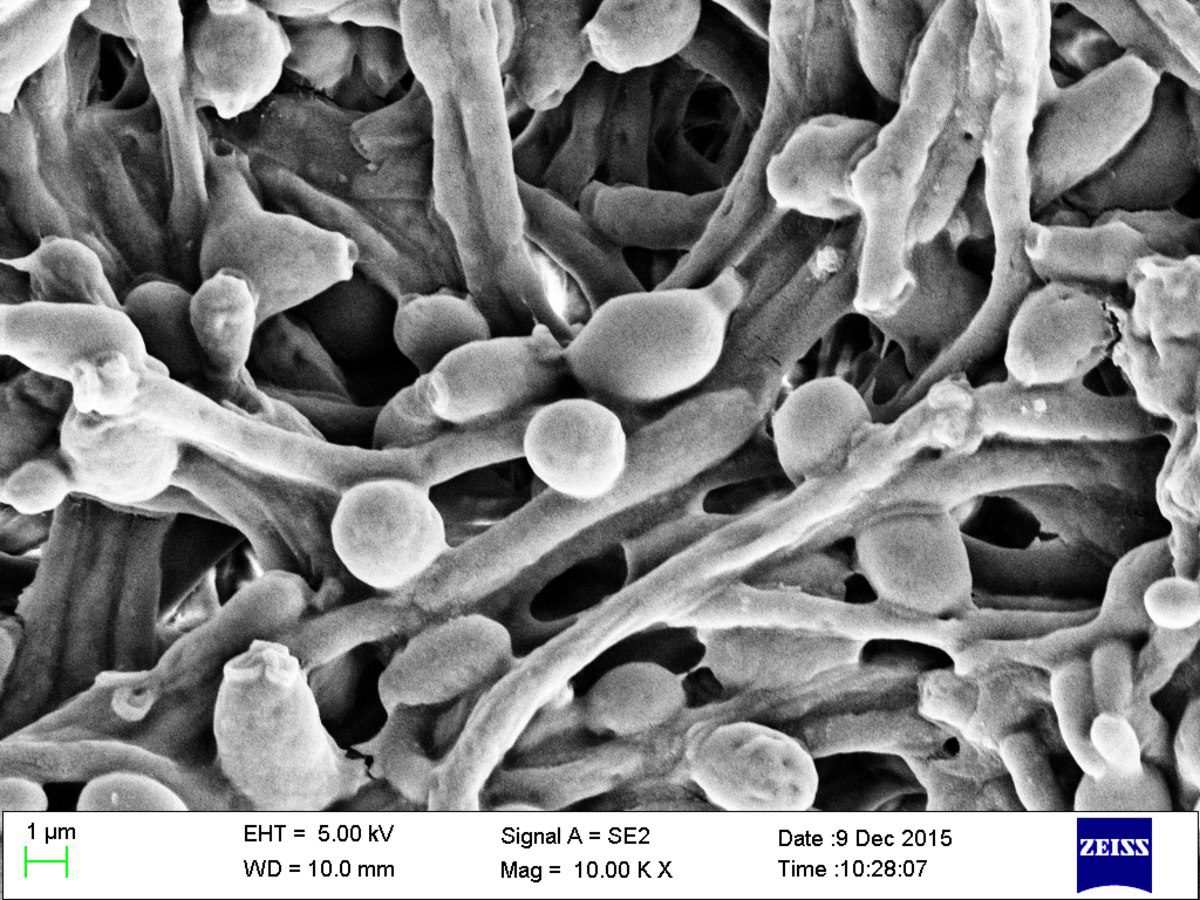Candida albicans – scheda micologica ed approfondimenti