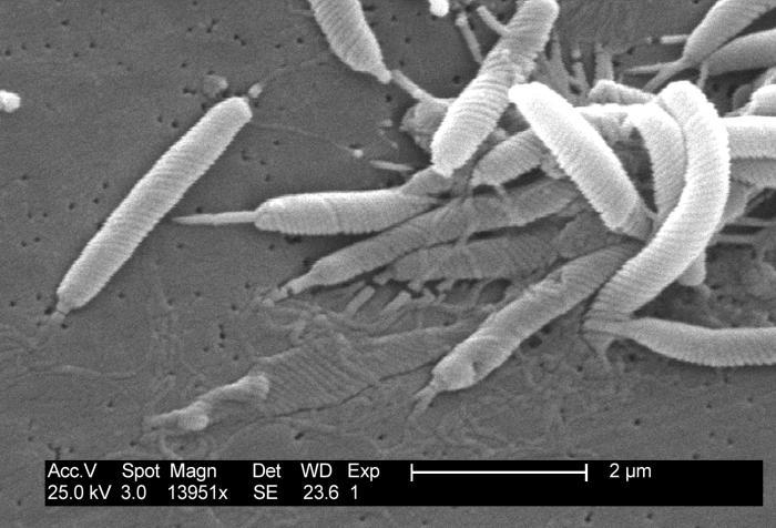 Figura 4 - Helicobacter pylori al microscopio elettronico a scansione 