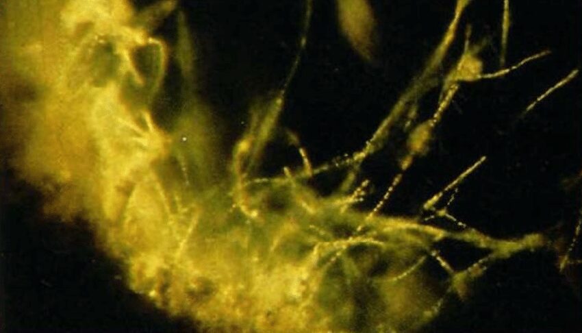 Figura 3 - Colonie di solfobatteri contenenti granuli di zolfo 