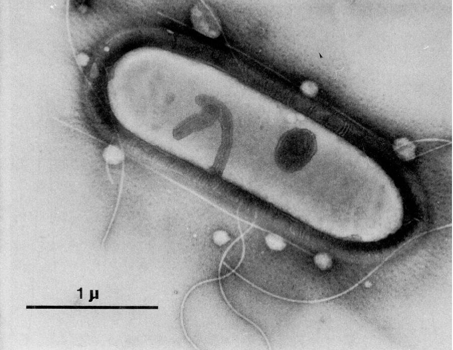 Figura 1 - Immagine al microscopio di una cellula del batterio Clostridium ljungdahlii
