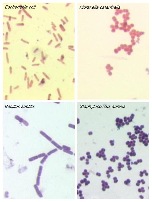 Utilizzo della colorazione di gram per l'identificazione di microrganismi patogeni.