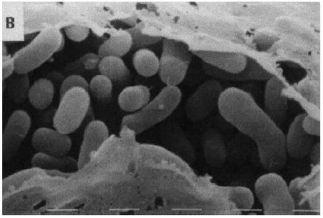 Methylobacterium nel tessuto mammario