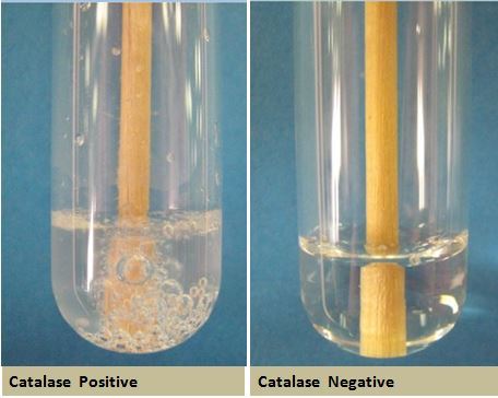 Figura 2 - test della catalasi su provetta: a sinistra presenza dell'enzima catalasi e produzione di bolle, a destra assenza dell'enzima catalasi