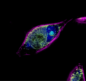 Cellule di C. trachomatis inglobate in cellule HeLa al microscopio. In fucsia si vede la membrana delle cellule HeLa, in blu il citoplasma, in azzurro il nucleo e in verde C. trachomatis