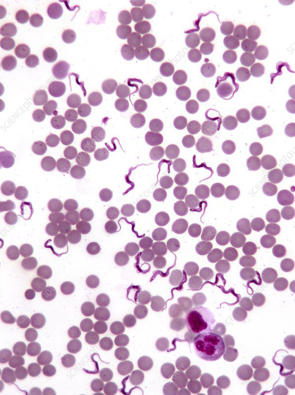 striscio di sangue colorato con wright giemsa in cui è presente Trypanosoma