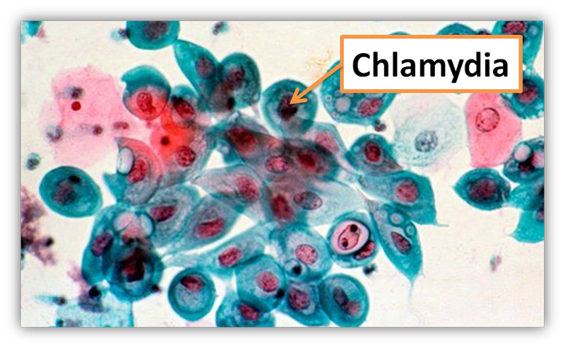 Colture di Chlamydia in cellule HeLa