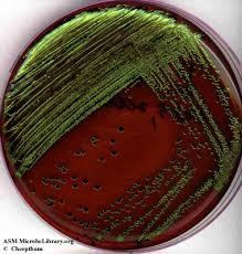 E. coli