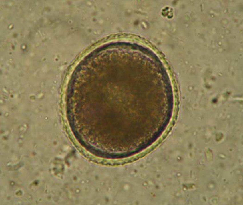 Uovo di ascaride al microscopio
