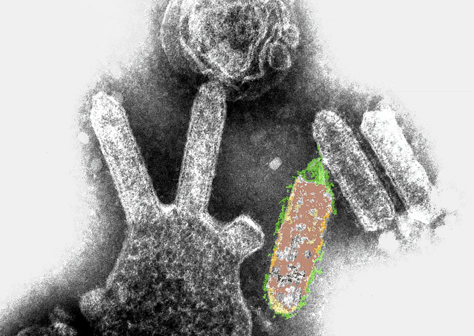 Micrografia elettronica a trasmissione colorata del Lyssavirus di pipistrello australiano. Gli oggetti a forma di proiettile sono i virioni e alcuni di essi si staccano da una cellula. 