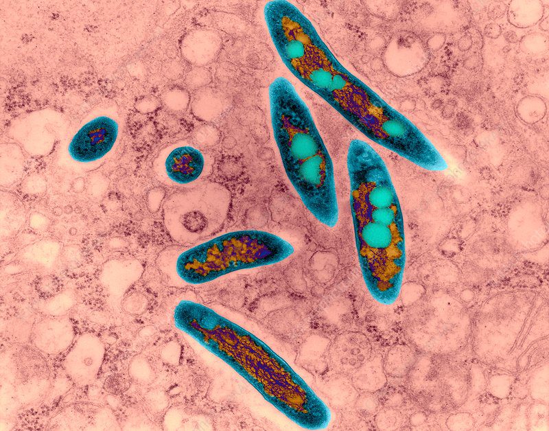 Mycobacterium avium, infezione del polmone; immagine ottenuta con il microscopio elettronico a trasmissione (TEM)