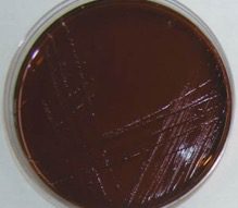 Proteus mirabilis