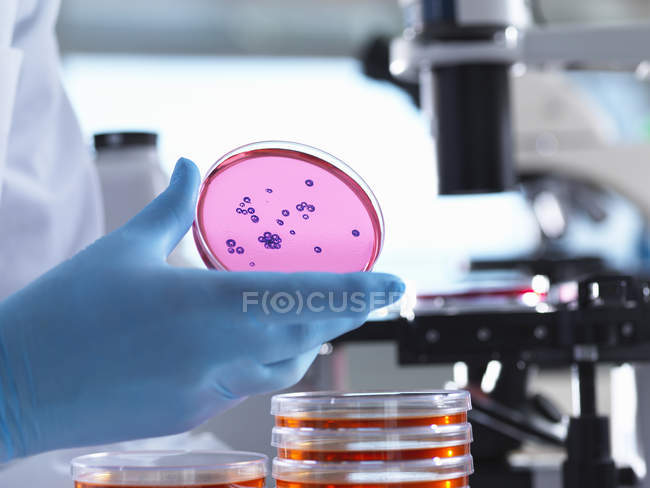 Immagine di capsula Petri con colonie batteriche