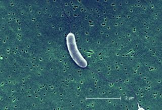 Foto al microscopio elettrico a scansione di cellule di Vibrio vulnificus.