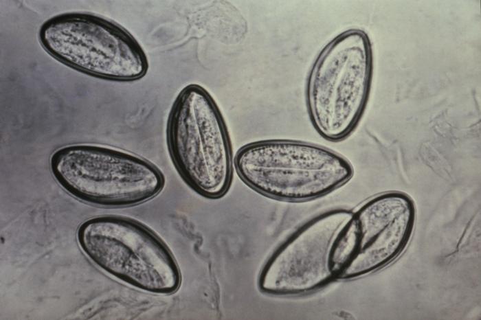 uova di E. vermicularis