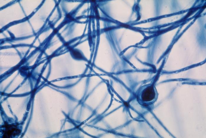 colorazione al lattofenolo cotton blu di Microsporium audouinii fungo patogeno umano