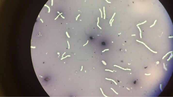 aspetto del vetrino all'osservazione al microscopio