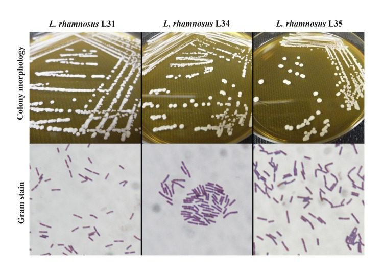 Colorazione di Gram e morfologia di Lactobacillus rhamnosus.
