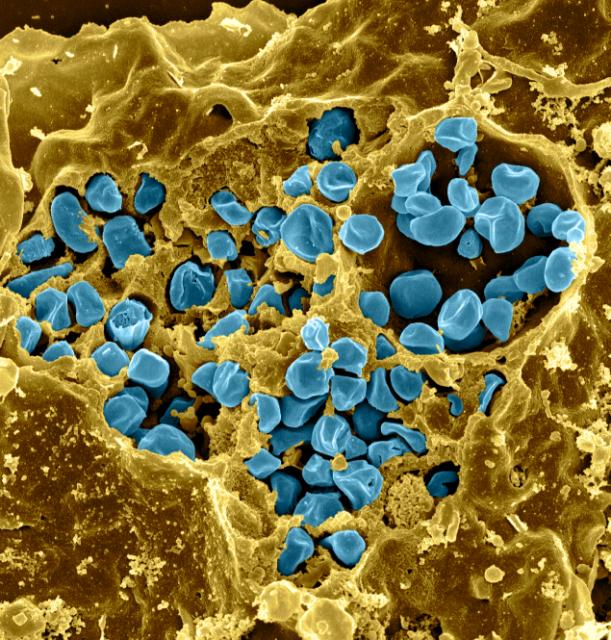 Aspetto microscopico della Francisella tularensis.