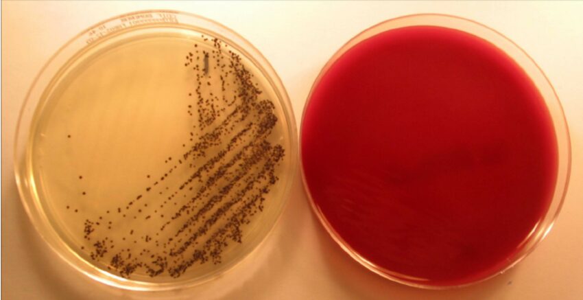 Colonie di C. difficile dopo 24 ore in CHROMID® agar (sinistra) e assenza di crescita in terreno convenzionale (esempio, Brucella agar, a destra).