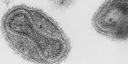 Virus del vaiolo, foto realizzata mediante microscopia elettronica
