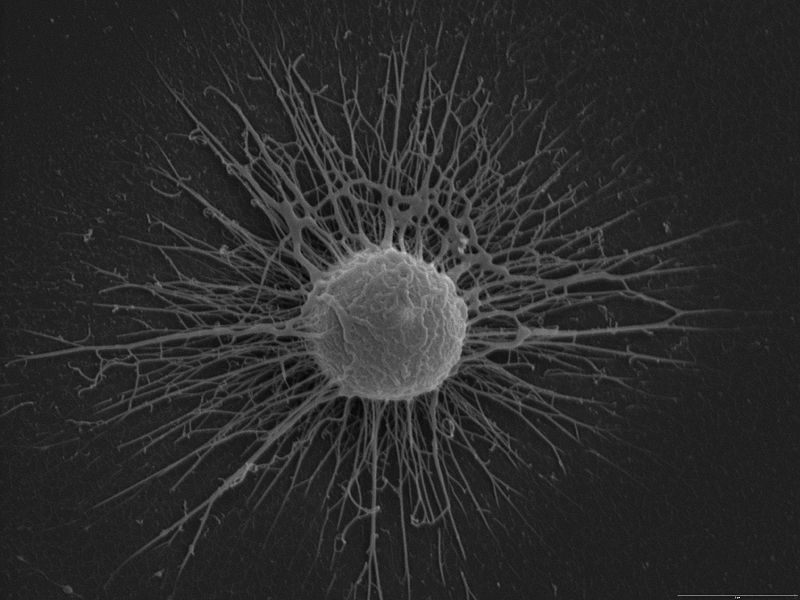 Cryptococcus neoformans al microscopio elettronico 