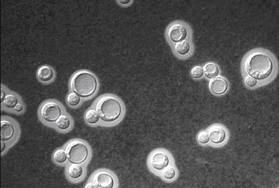 Cryptococcus neoformans