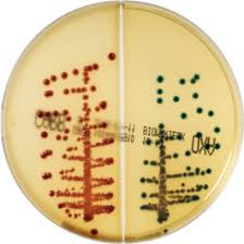 Figura 1 - Immagine della crescita in 24 ore di E.coli KPC (metá CARB, in rosso) e K.pneumoniae OXA-48 (metá OXA, in verde)