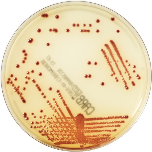  Immagine del CHROMID agar con colonie di E. coli ATCC®1011230 (NDM1) in rosa