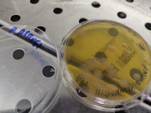 Pseudomonas aeruginosa su TSA+LT