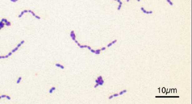Streptococcus agalactiae, aspetto microscopico