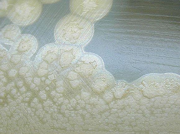 Figura 2 - Clostridium botulinum cresce su agar tuorlo d'uovo dopo 72 ore di incubazione. E’ possibile osservare la reazione della lipasi, descritta dall’area brillante intorno a ogni colonia