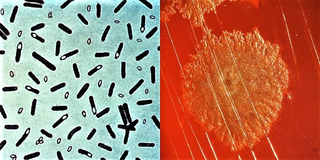 Clostridium botulinum al microscopio ottico (sinistra) in cui si osservano le spore e su blood agar (destra)
