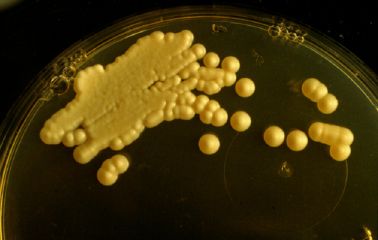 Colonie di Cryptococcus neoformans su SAB + CAF