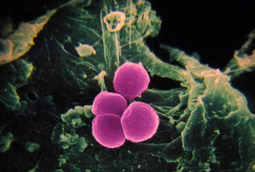 Foto raffigurante soldi “sporchi” dal museo di microbiologia di Amsterdam
