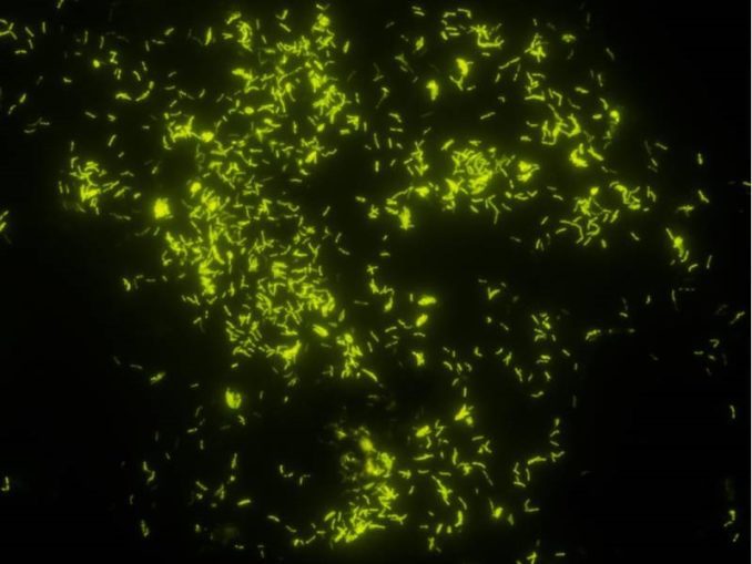 Colorazione con Auramina: i micobatteri sembrano piccoli frammenti d’oro su uno sfondo totalmente nero. Colorazione usta nella microscopia a fluorescenza.