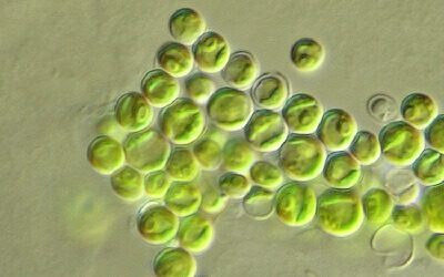 Immagine al microscopio di Chlorella sorokiniana