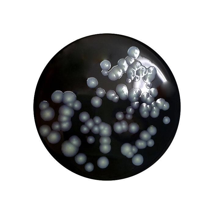 Colonie di Legionella pneumophila in agar BCYE
