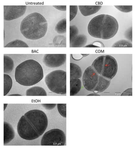 Nell'immagine si visualizzano le anomalie nella divisione cellulare, dovute all'utilizzo combinato di bacitracina e cannabidiolo.