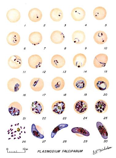 Sviluppo delle varie fasi di Plasmodium falciparum nell'eritrocita dell'individuo.