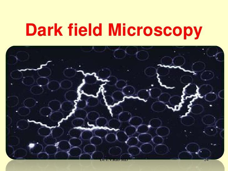  Aspetto della B. burgdorferi microscopio su campo oscuro